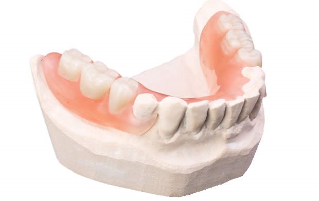 Types Of Dentures Pollock ID 83547